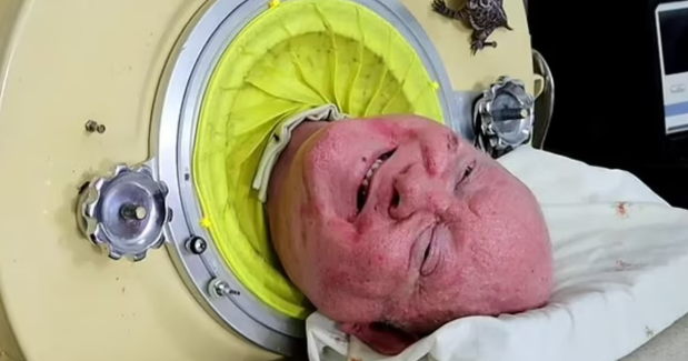 Ömrünün 72 ilini metal kapsulda keçirən kişi vəfat etdi - FOTOLAR